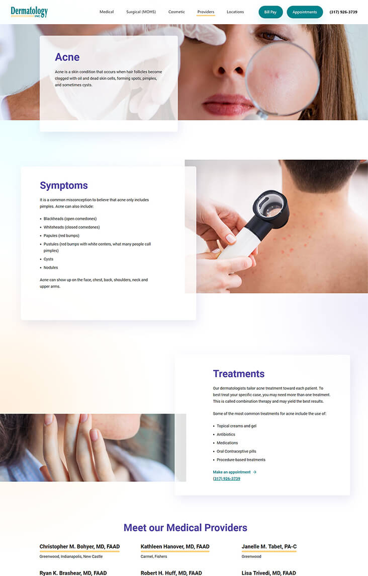 Acne medical service webpage