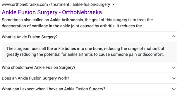 Google FAQ page rich results